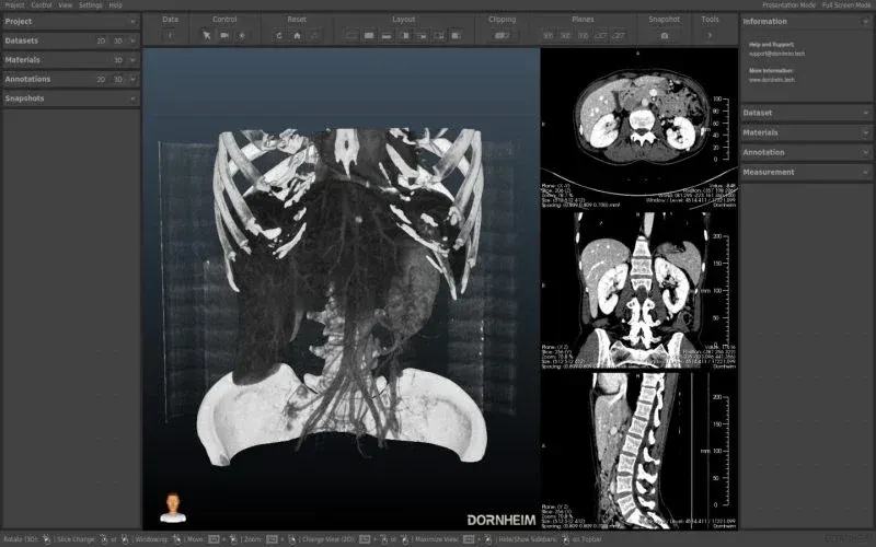 Todo sobre el Formato DICOM: Un Estándar en Imágenes Médicas