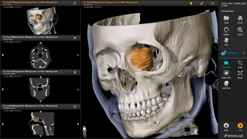 protocolo-DICOM-800x449-1.webp